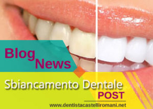 categoria sbiancamento dentale del blog dentistacastelliromani.net
